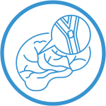 Cerebrovasular Disease